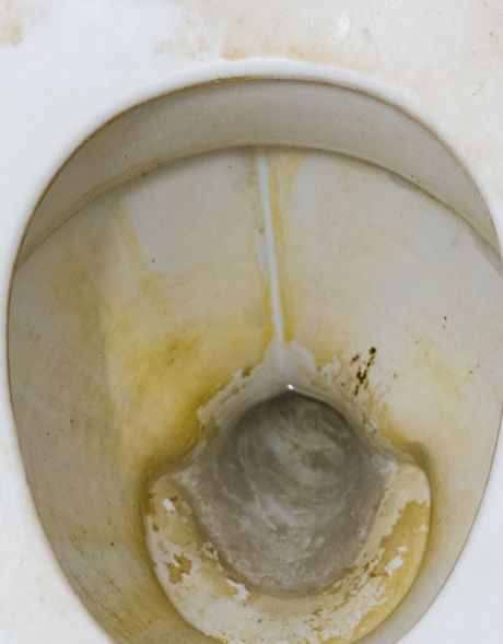 Dirty toilet.
